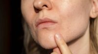 Kulit Kering dan Bersisik? Ini Kandungan Wajib di Moisturizer agar Tetap Lembap Sepanjang Hari